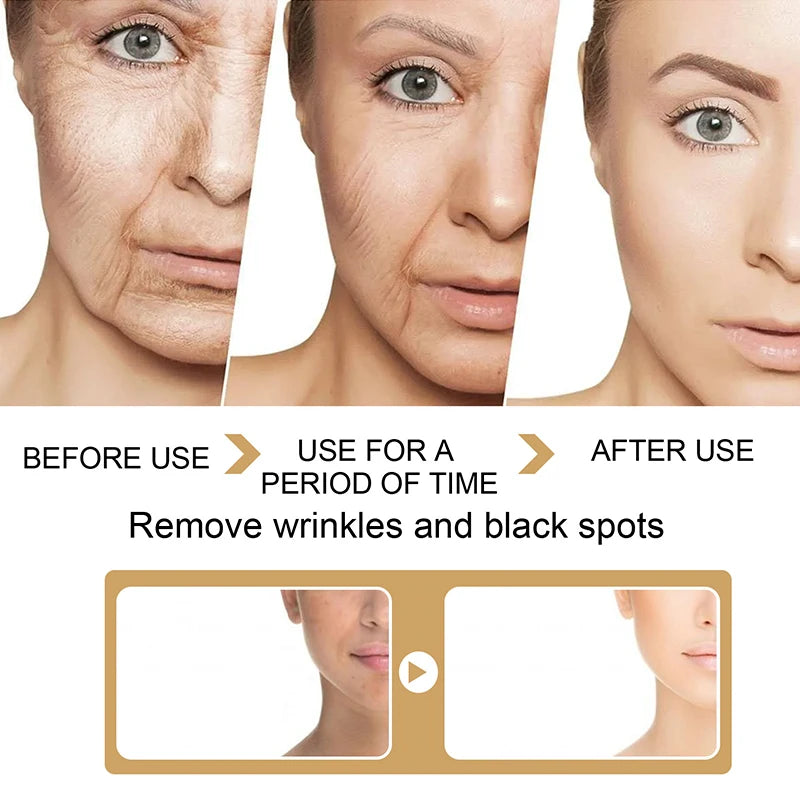 30ml Turmeric Oil Skin Lightening Serum