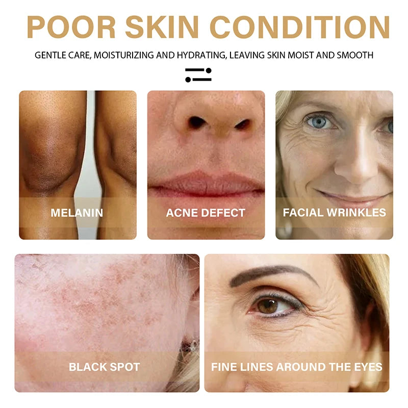30ml Turmeric Oil Skin Lightening Serum