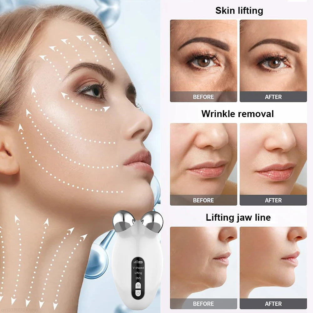 EMS Face Lifting Massager