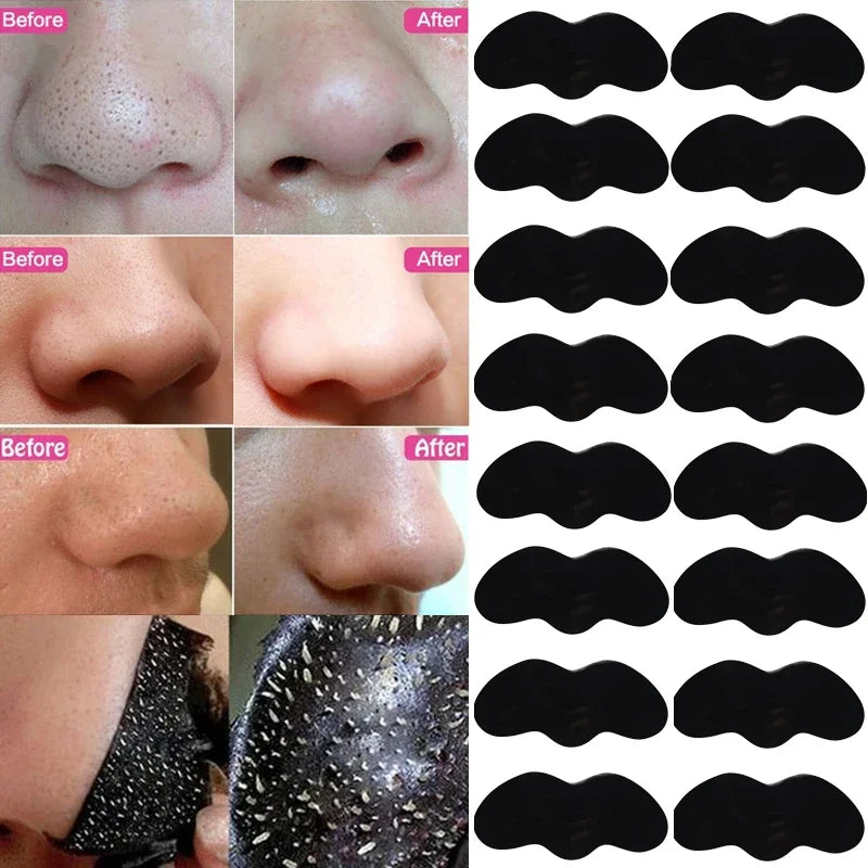 Blackhead Removal Mask