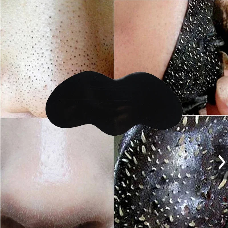 Blackhead Removal Mask