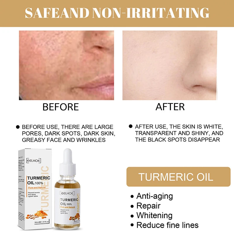 30ml Turmeric Oil Skin Lightening Serum